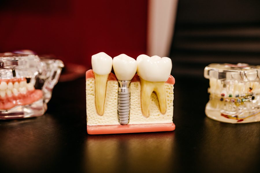 best-no-waiting-period-dental-insurance-in-2022-benzinga