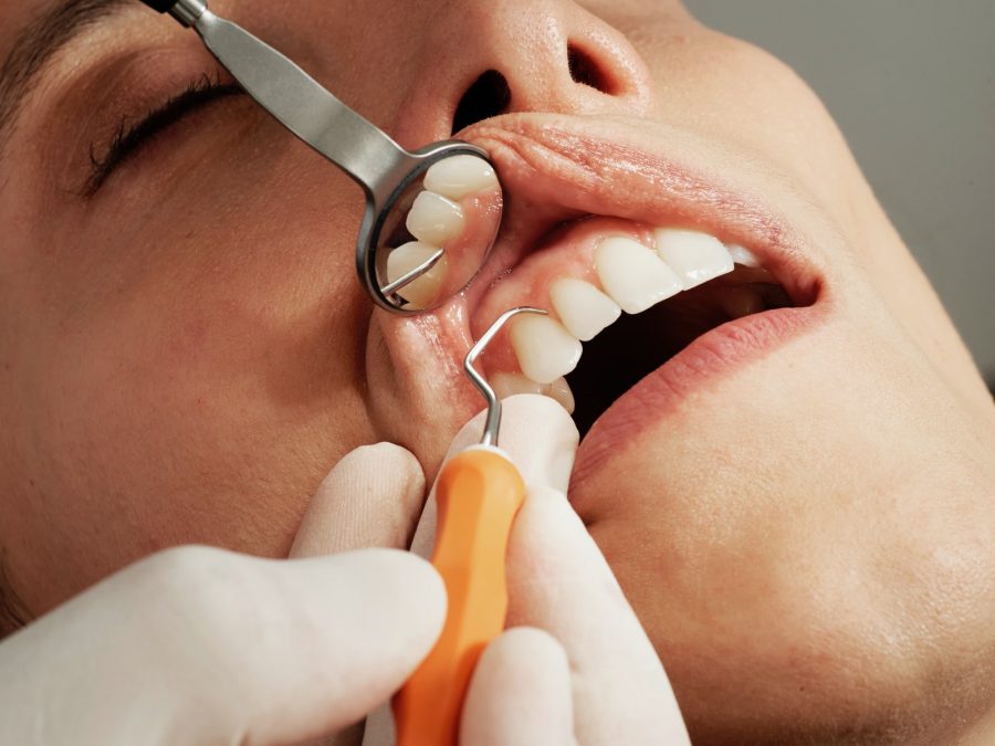 Your Employer Doesn’t Pay for Dental Insurance. Is it Worth Buying?