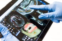 What Type of Dental Care Will be Covered by Medicare?