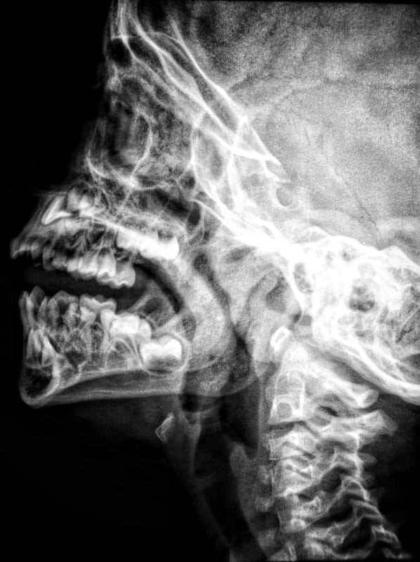How Much Do Dental X Rays Cost With Insurance A Helpful Guide Benzinga how-much-do-dental-x-rays-cost-with-insurance-a-helpful-guide-benzinga